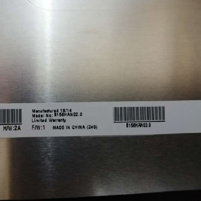 Panel LCD de 15,6 pulgadas con franja vertical AUO B156HAN02.0 1920*1080