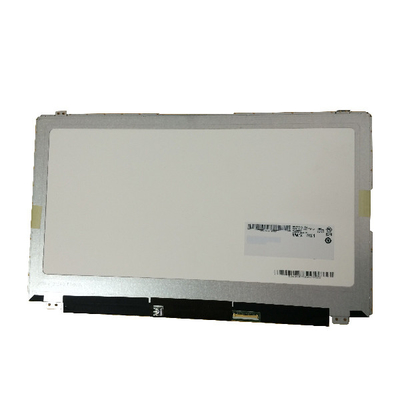 Tacto LCD 1366*7638 40pin B156XTT01.2 del ordenador portátil 15,6 de la raya vertical del RGB