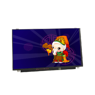 Pantalla LCD TFT de 15,6 pulgadas con banda vertical RGB