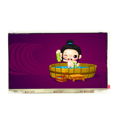 Buen precio El original está en stock. Pantalla LCD de 17 pulgadas. en línea